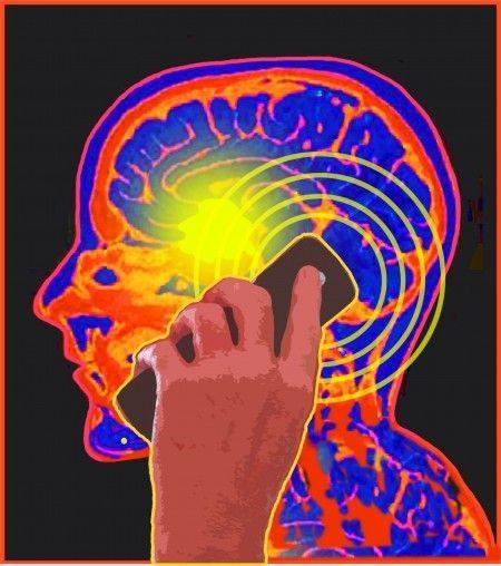 DANNI CAUSATI DAL CELLULARE - aumento del 400% del rischio di Cancro al cervello; - le radiazioni potrebbero causare danni alla fertilità maschile; - l'esposizione alle radiazioni può scatenare