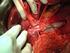 Chirurgia - tumori del fegato e delle vie biliari