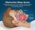 Sindrome Apnee Ostruttive nel Sonno (OSAS): quale prevenzione possibile