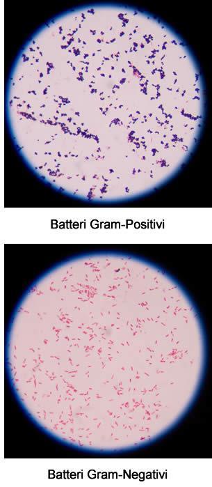 Batteri Gram-positivi e Gram-negativi I batteri Gram-positivi e Gram-negativi si chiamano così per il particolare modo che hanno di reagire alla colorazione di Gram, dal nome del medico danese
